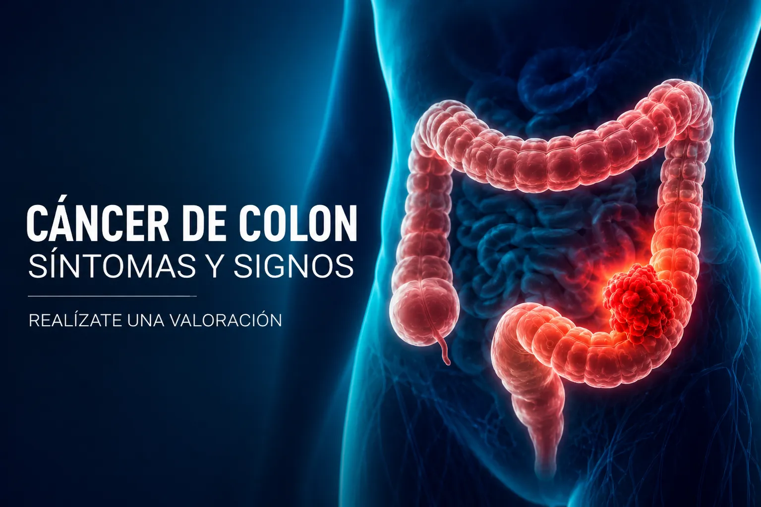 Cáncer de colon: síntomas, factores de riesgo y detección
