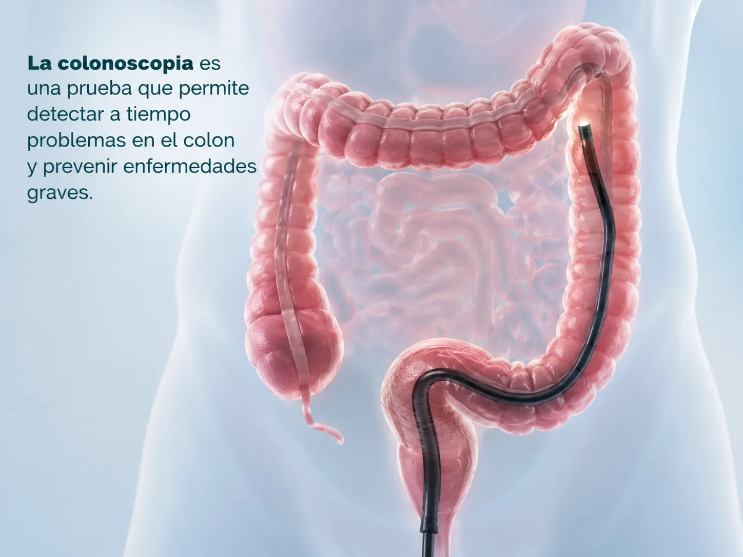 Preparación para colonoscopia: guía para el paciente
